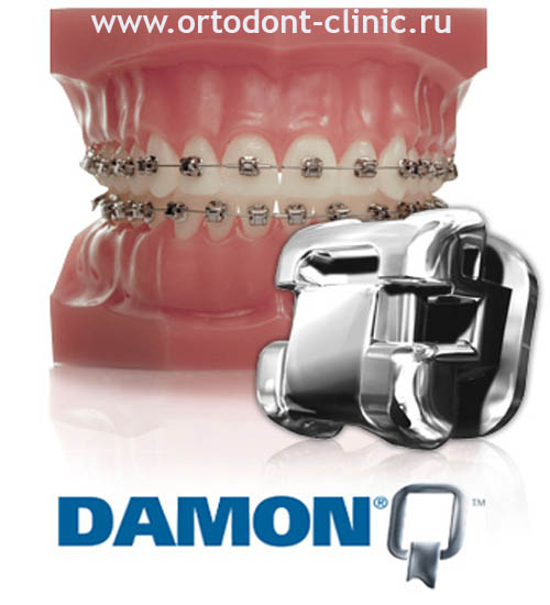 ������� damon q